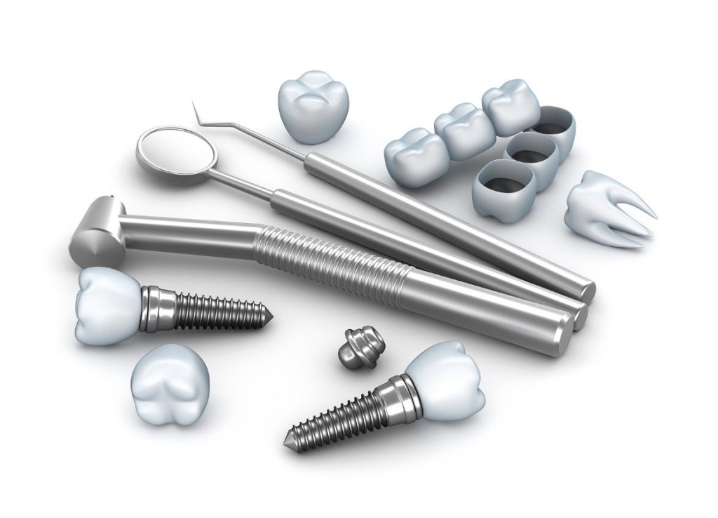 Do Your Missing Back Teeth Need To Be Replaced by Dental Implants?