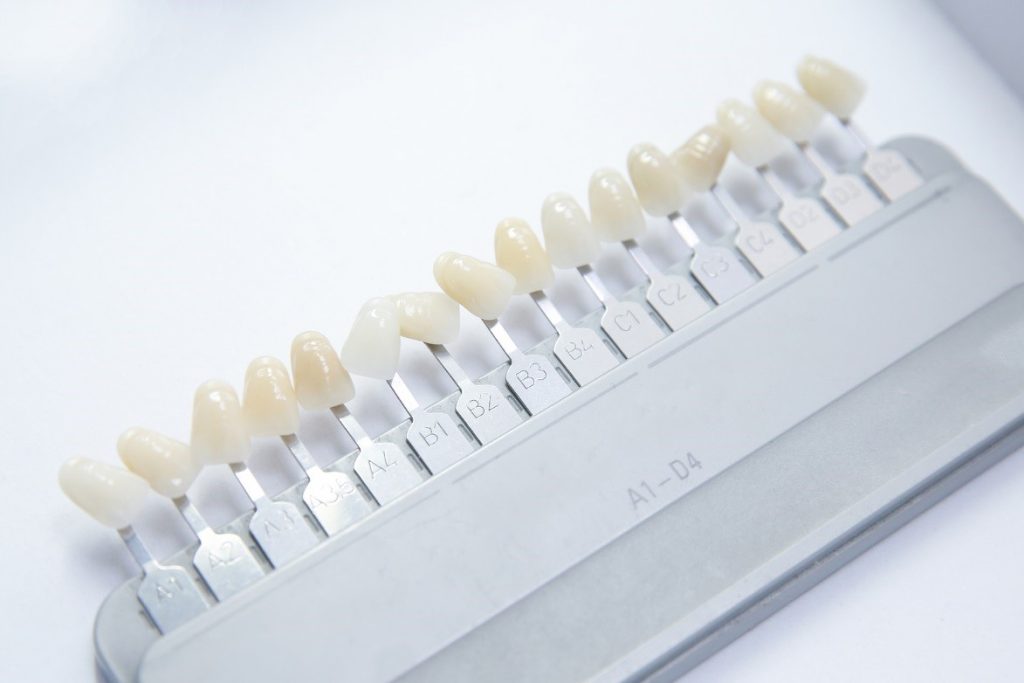 Dental-Implants