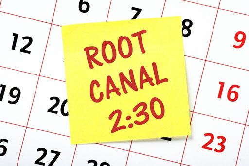 Root-Canals