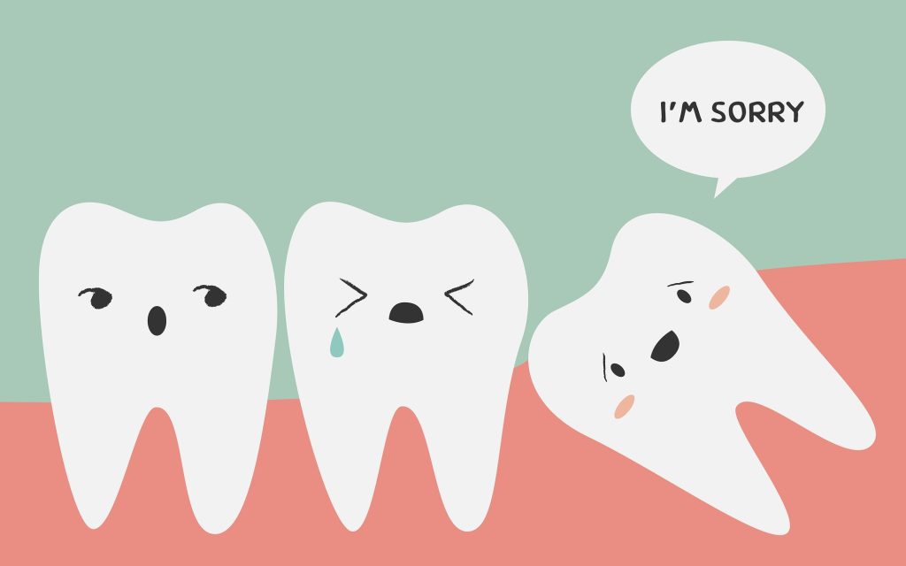Colorado Springs Dentist: When Should Your Wisdom Teeth Be Removed?