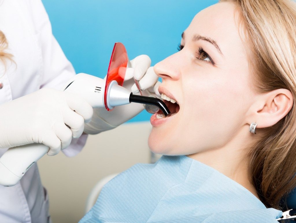 cavities-treatment
